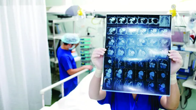 Vitamin B1 giúp phục hồi não