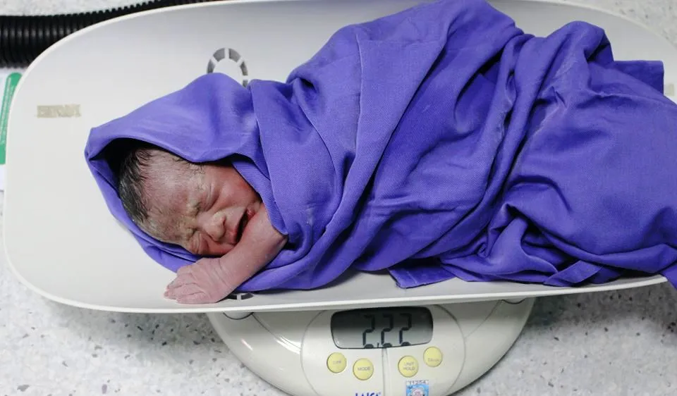 Con của sản phụ Đ.Th.L. sau ca mổ