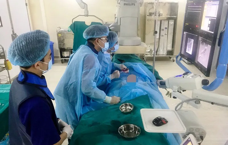 Đốt u gan bằng vi sóng 