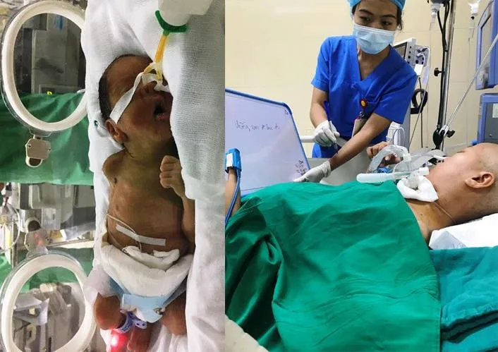 Nỗ lực hết tâm sức để hai mẹ con sản phụ mắc ung thư sớm được gặp nhau