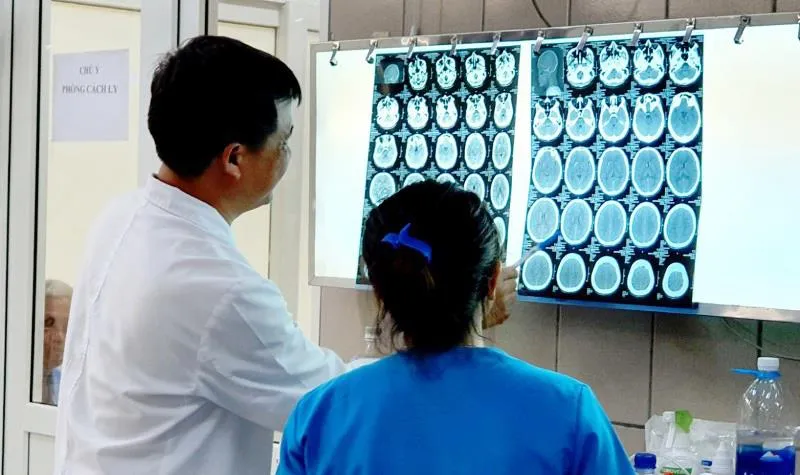 “Đập đá” thanh niên 27 tuổi ngộ độc, xuất huyết não 