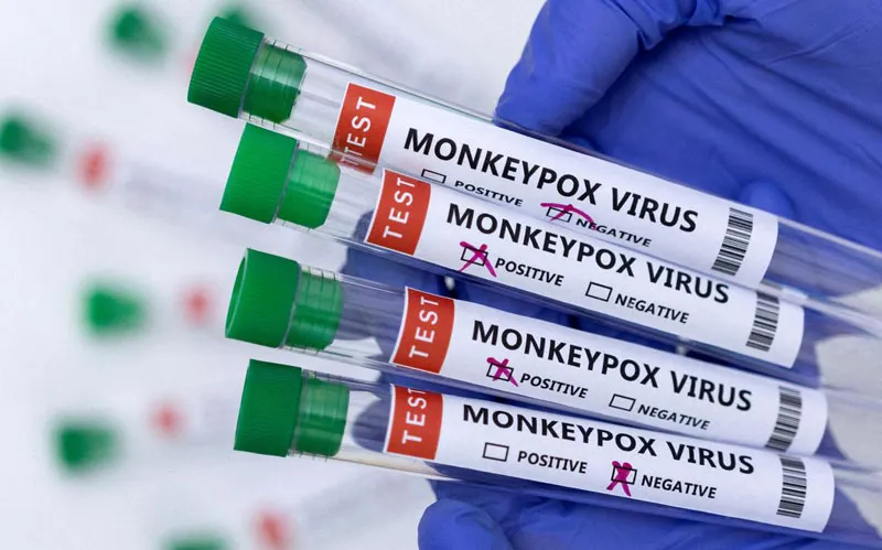 Việt Nam ráo riết chuẩn bị vaccine, thuốc điều trị đậu mùa khỉ
