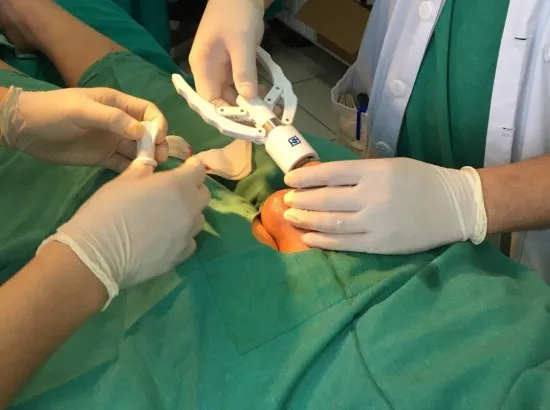 Bệnh nhân tai biến nặng sau thủ thuật cắt bao quy đầu ở bệnh viện tuyến trung ương