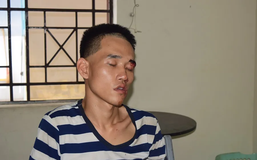 Khởi tố đối tượng cứa cổ người đàn ông đi viếng tang