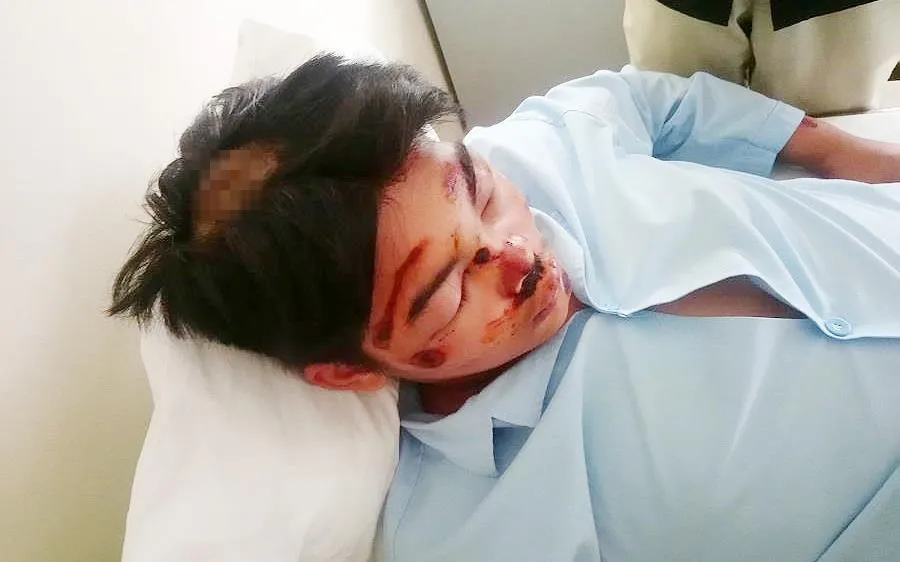 Em T. đang điều trị tại bệnh viện.