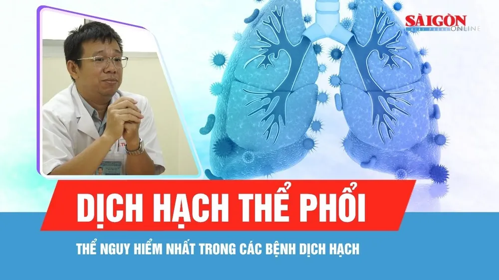 Dịch hạch tại Nga: Có đáng lo ngại?