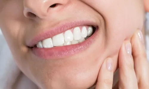 Có nên nhổ răng khôn?