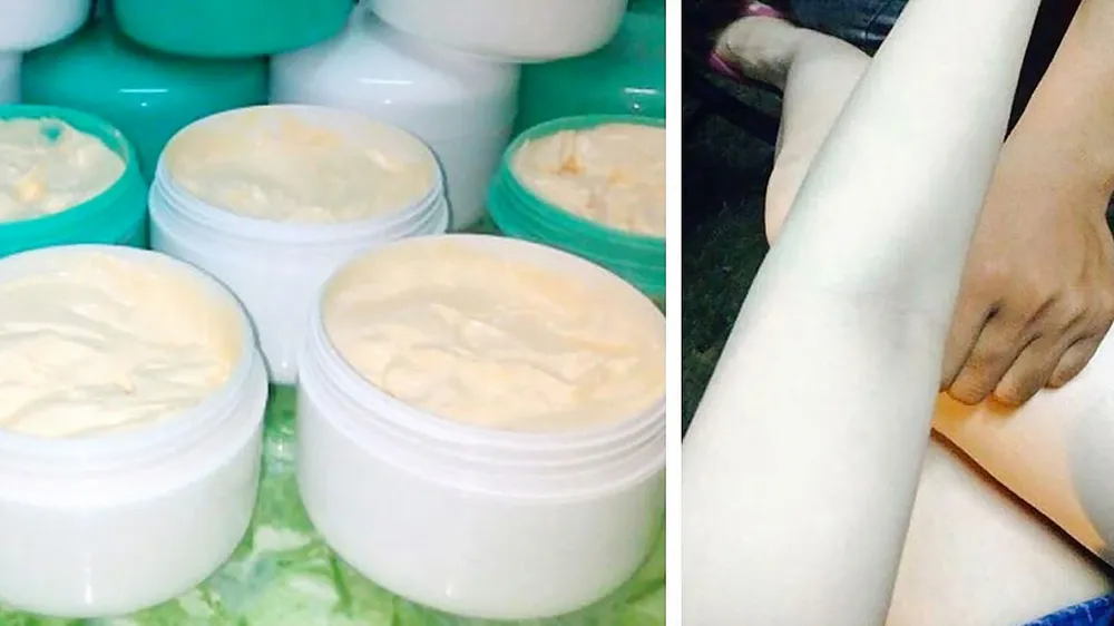 Những sản phẩm tẩy trắng da cấp tốc tiềm ẩn nhiều mối nguy hiểm cho người sử dụng
