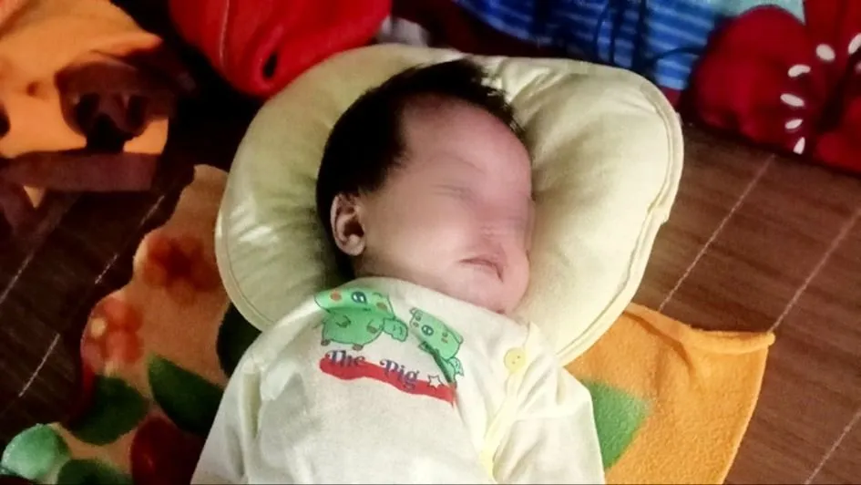 Con bị khoèo chân bẩm sinh, bố mẹ cạn kiệt tiền cứu chữa