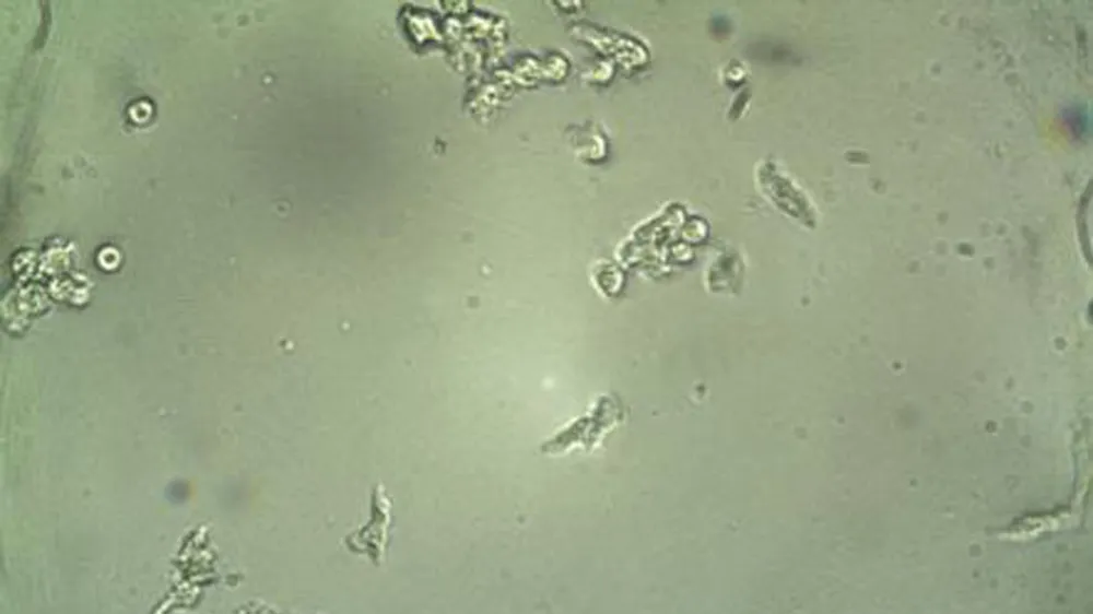 Đã điều chế thành công vaccine tái tổ hợp có khả năng tăng cường hệ miễn dịch đối với đơn bào Entomoeba histolytica, tác nhân gây bệnh do amip 