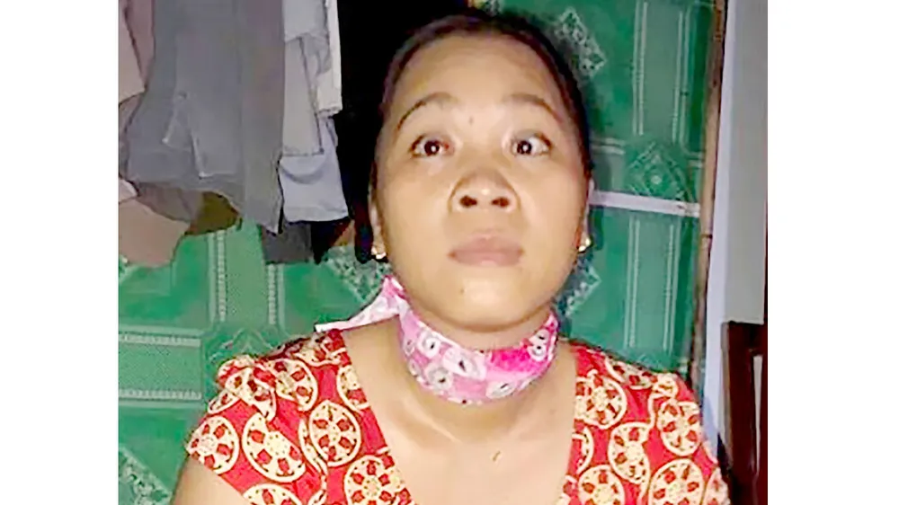 Người phụ nữ nghèo bị u não, mất thị lực