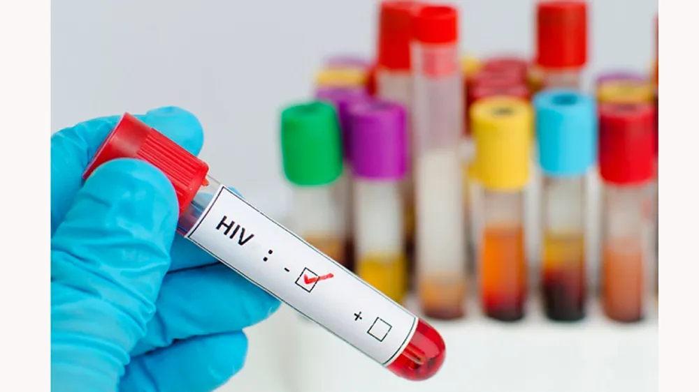Canada mở rộng xét nghiệm HIV