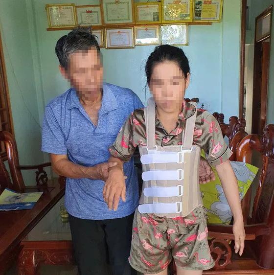 Chị Anh bị đánh chấn thương 5 đốt sống, sau khi ra viện phải ở nhà nhà bố mẹ đẻ, mọi sinh hoạt phải có người dìu