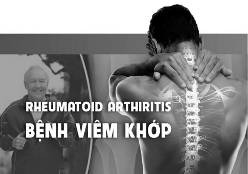 Tặng sách hỗ trợ điều trị xương khớp tại nhà
