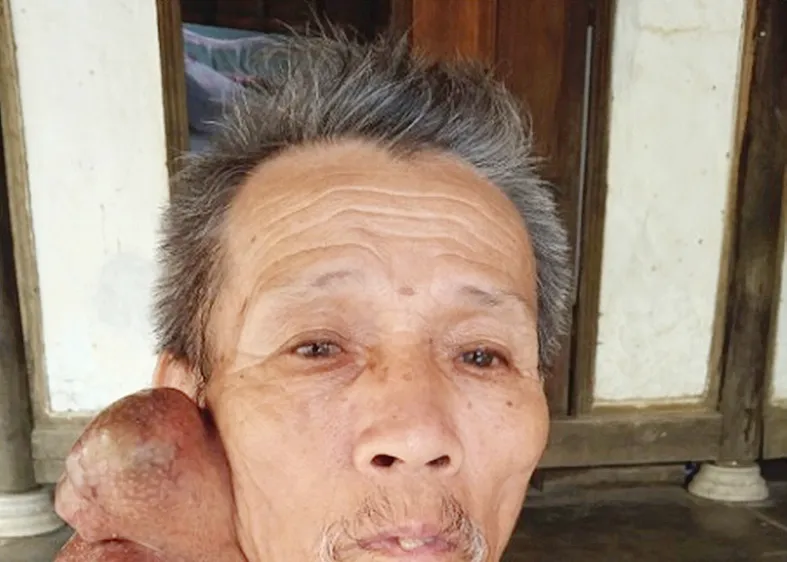 Ông Nguyễn Văn Huệ