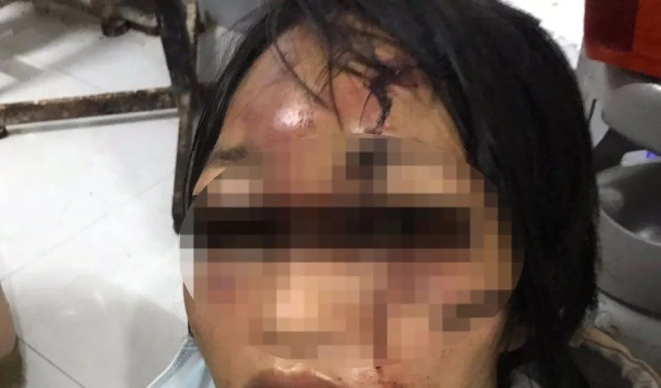 Bắt đối tượng đánh đập dã man người tình cùng con gái 
