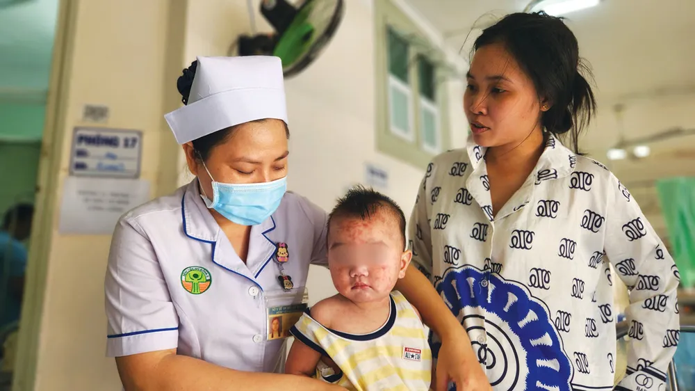 Dịch sởi chưa hạ nhiệt