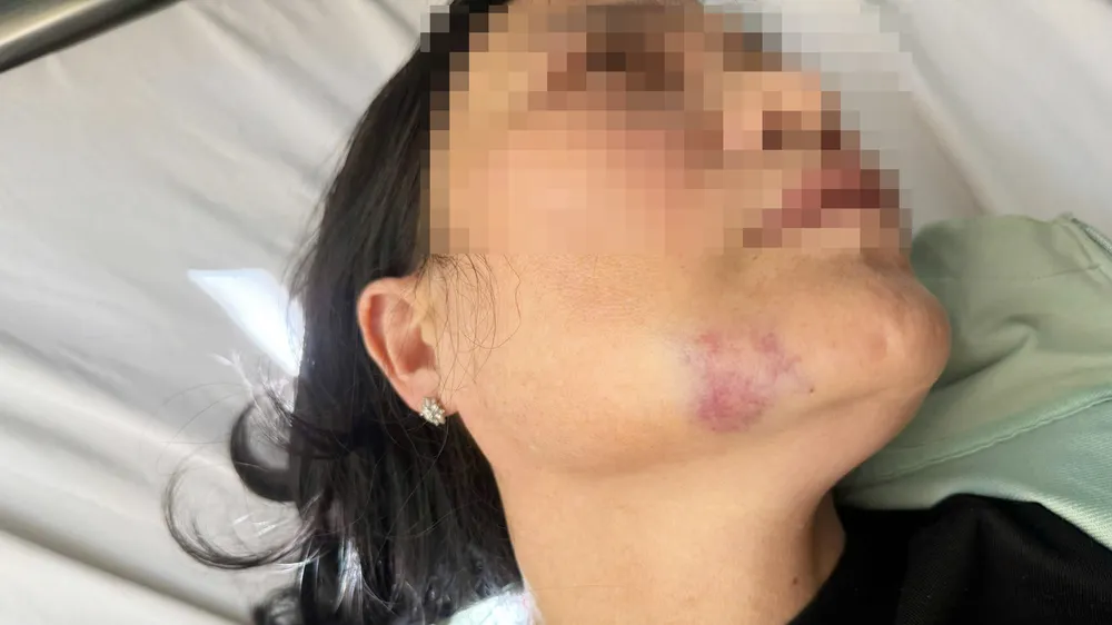 Bà T. bị thương, vẫn đang điều trị