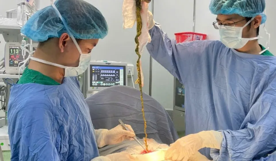 Lấy búi tóc ra khỏi cơ thể cháu bé