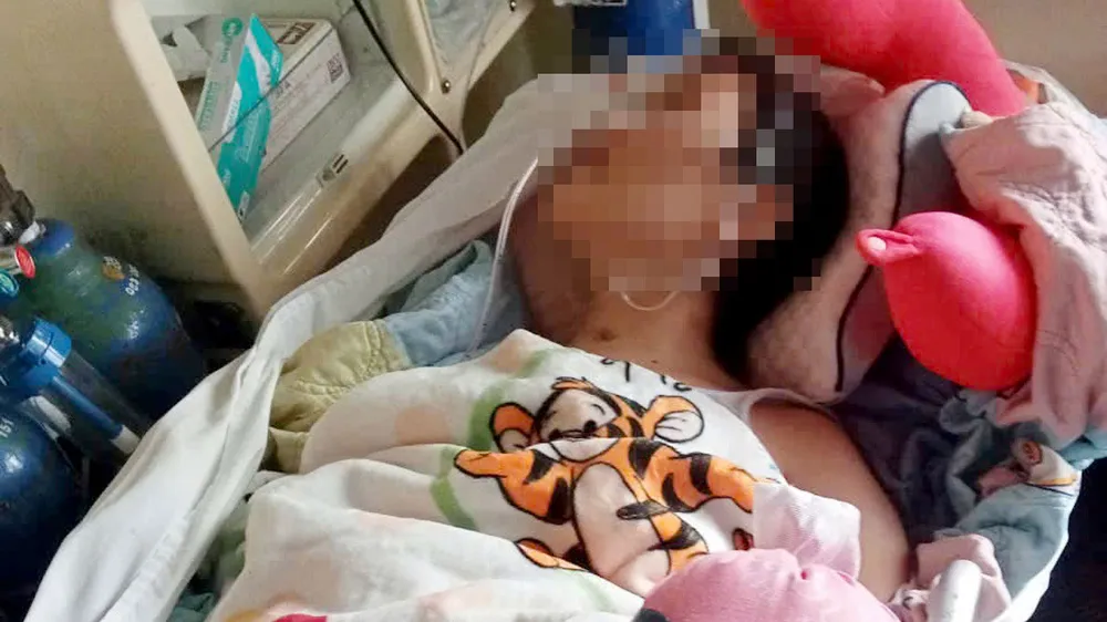 Nữ sinh tái phát tổn thương não sau tai nạn