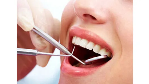 Việt Nam có tỷ lệ mắc bệnh răng miệng hàng đầu thế giới