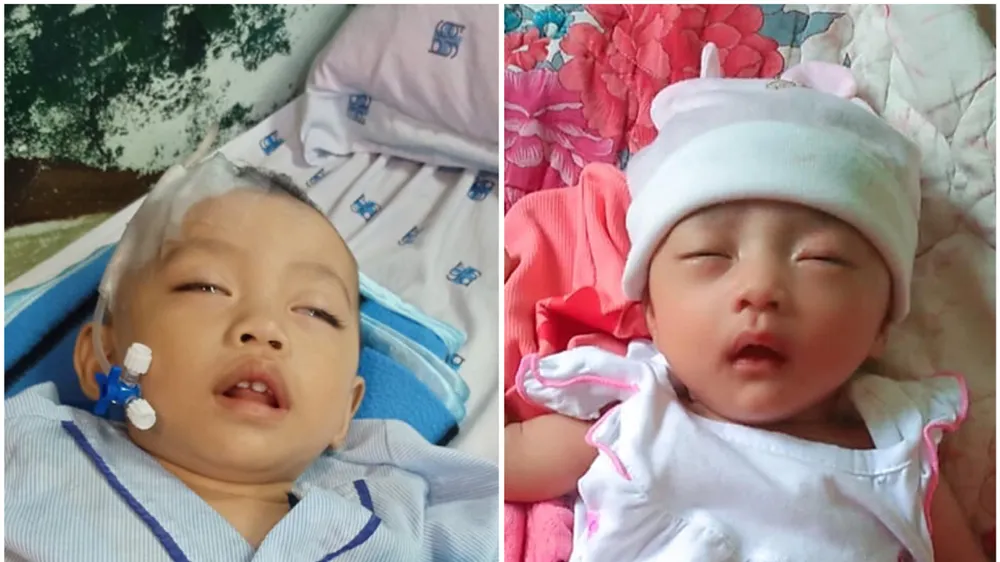 Gia đình 4 người bệnh tim bẩm sinh
