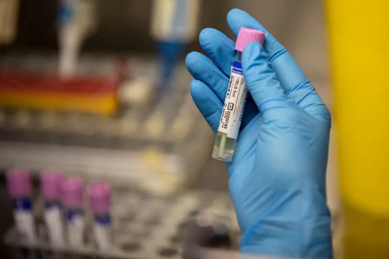 Mẫu thử nghi nhiễm virus đậu mùa khỉ tại một bệnh viện ở Mỹ