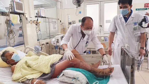 Một ngư dân bị suy gan thận vì nhiễm khuẩn Vibrio Vulnificus