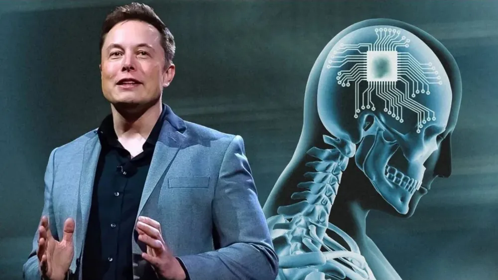 Dự án Neuralink của tỷ phú Elon Musk gây tranh cãi