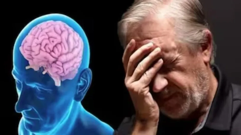 Minh họa về bệnh Alzheimer. Ảnh: THE HEALTH