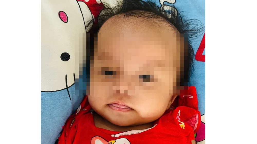 Bé gái bị bỏ rơi trên địa bàn xã Phú Quới. Ảnh: TTCTXH