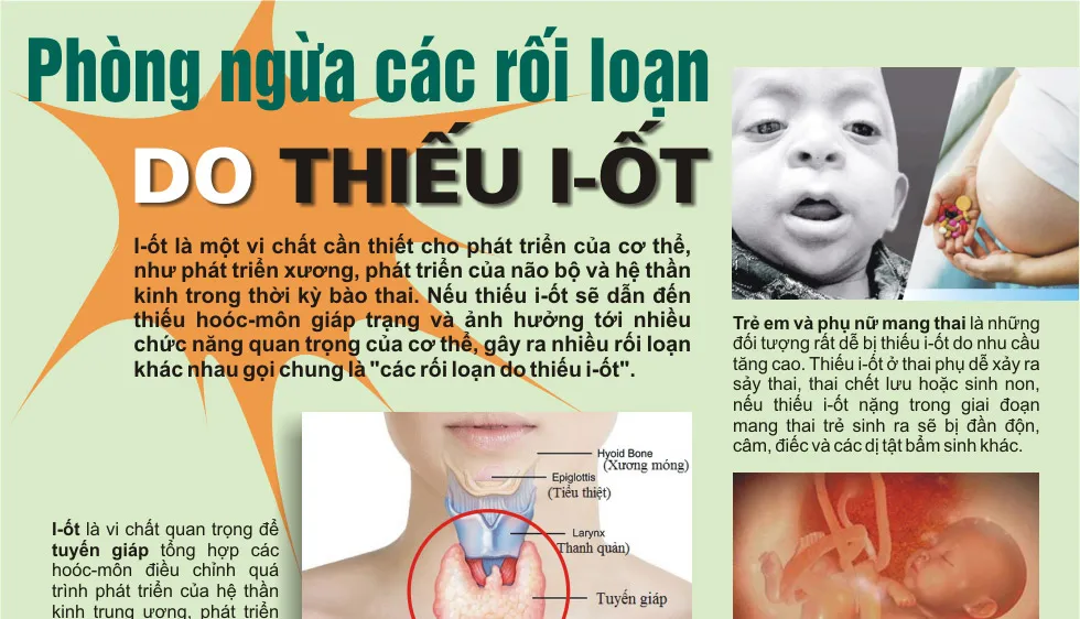 Cần bổ sung dinh dưỡng phù hợp phong ngừa thiếu i-ốt