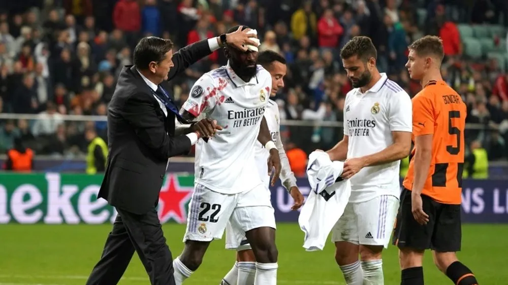Antonio Rudiger phải khâu đến 20 mũi sau ca tét đầu