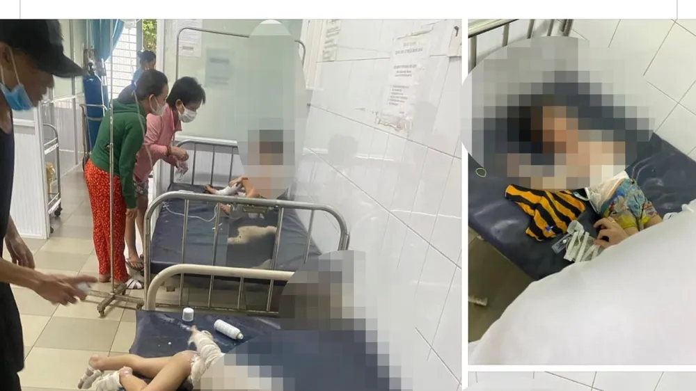 Thị xã Trảng Bàng, Tây Ninh: Hỏa hoạn làm 4 cháu bé bị bỏng nặng 