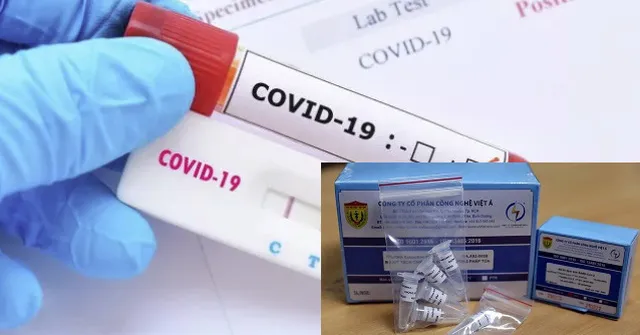 TPHCM chỉ đạo kiểm tra việc nhập khẩu, kinh doanh, mua sắm các loại kit test
