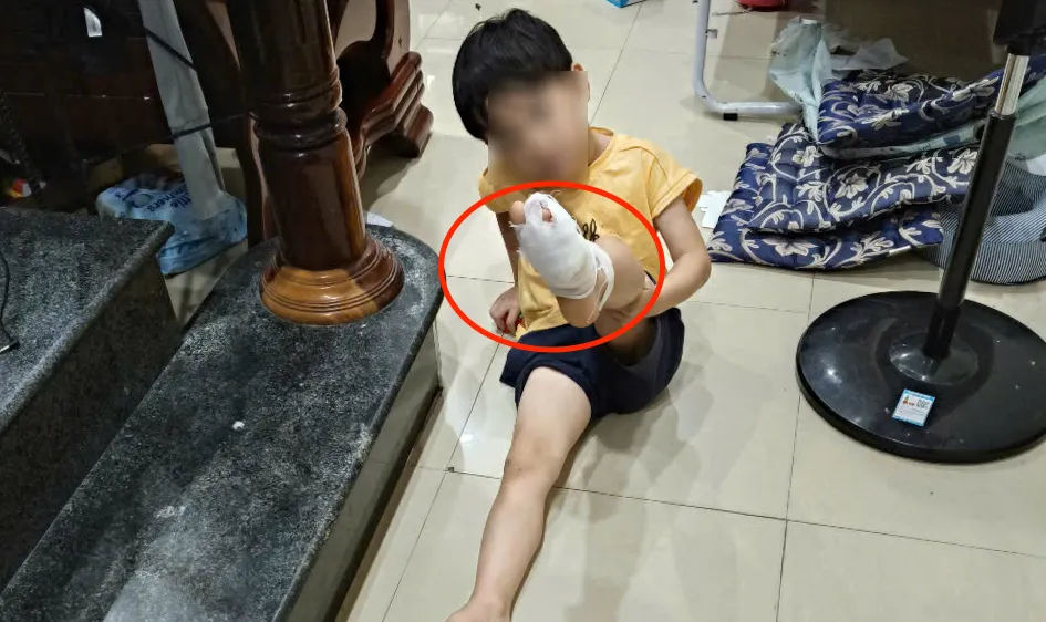 “Vật lạ” cứa chân người dân khi tắm biển ở Nha Trang
