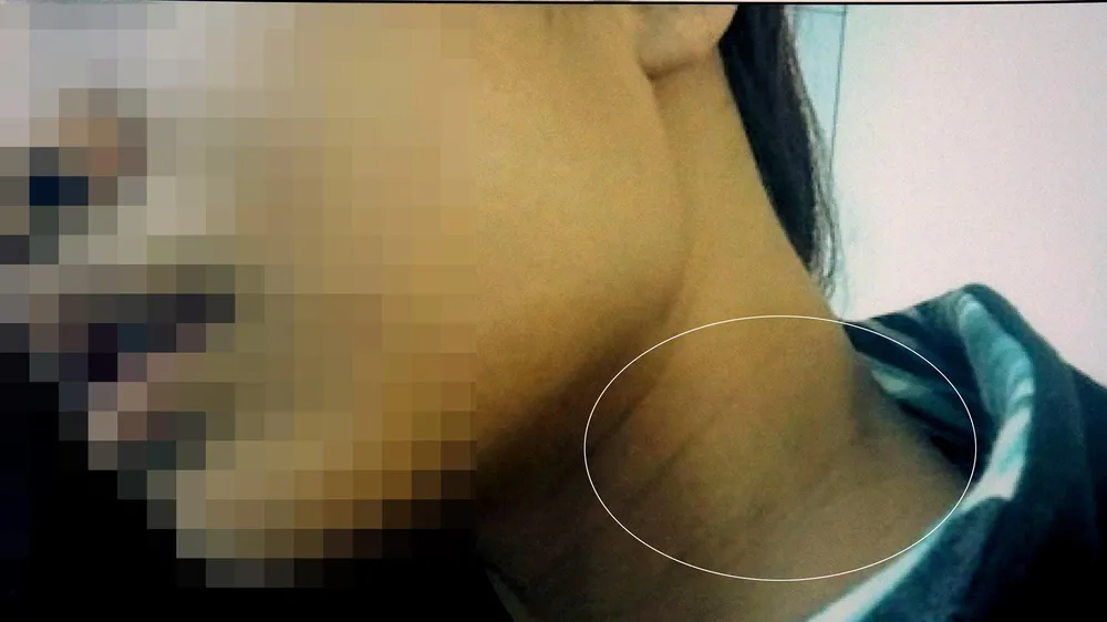 Chị Tr. với vết thương trên người. Ảnh: C.T.