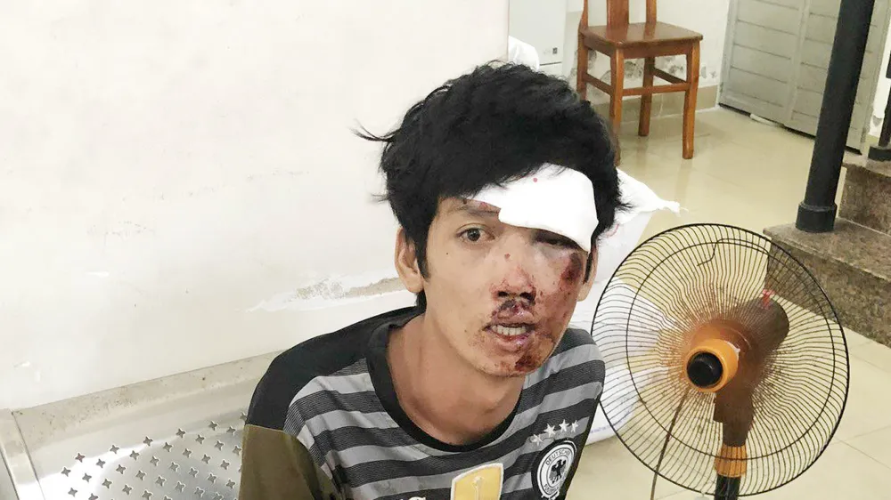 Tưởng tại tại cơ quan công an. Ảnh: CHÍ THẠCH 