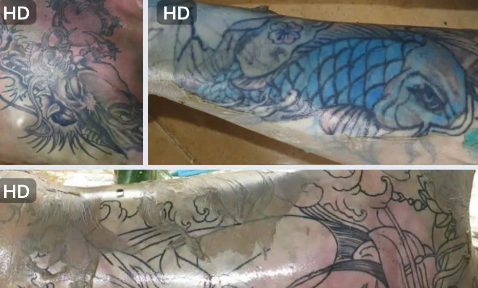 Hình xăm trên người nạn nhân 
