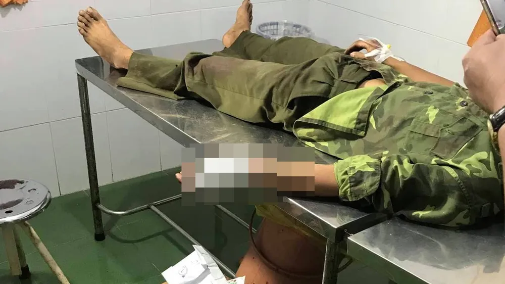 Bắt được nhóm đối tượng vây chém lực lượng kiểm lâm
