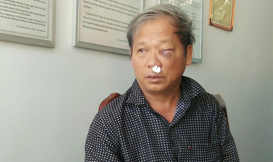 Phóng viên bị đánh dã man sau khi báo tin khai thác đất trái phép