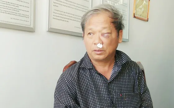 Chủ tịch UBND tỉnh Kon Tum chỉ đạo điều tra vụ phóng viên VTV bị hành hung dã man