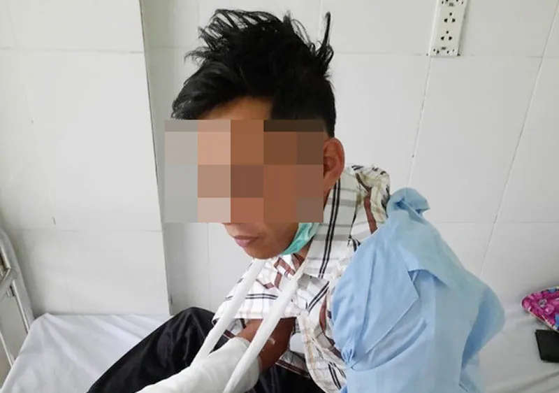 Anh Đỗ đang được điều trị tại bệnh viện