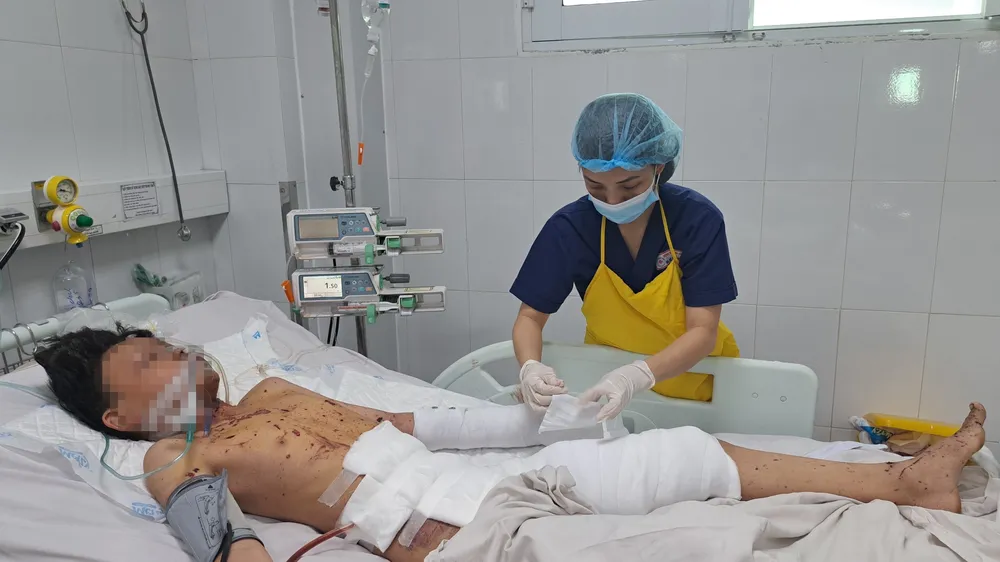 Bệnh nhân Đ.H.P. đa chấn thương do pháo nổ