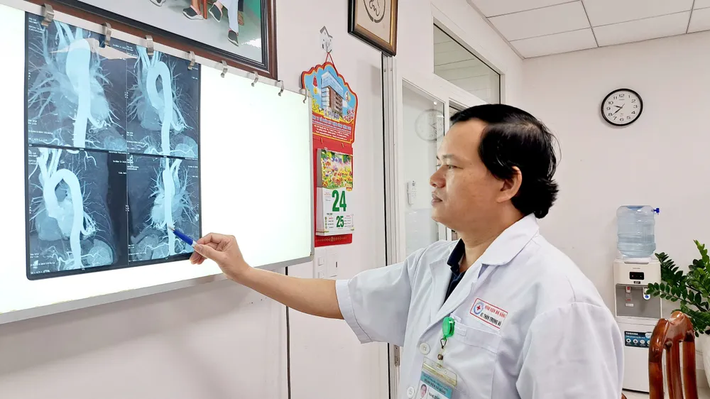 BSCKII Thân Trọng Vũ, Trưởng khoa Ngoại lồng ngực, Bệnh viện Đà Nẵng xem xét trên phim chụp CT Scan ngực. Ảnh: XUÂN QUỲNH