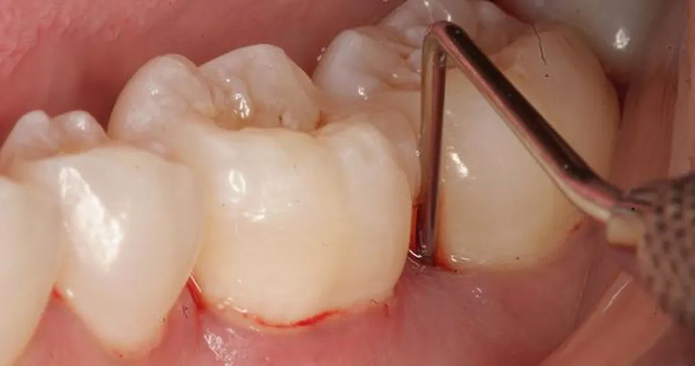 Cấp cứu thành công ca tai biến y khoa hiếm gặp