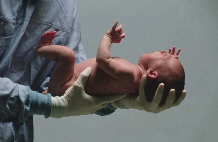 Nghiên cứu mới hỗ trợ điều trị tổn thương não ở trẻ sơ sinh
