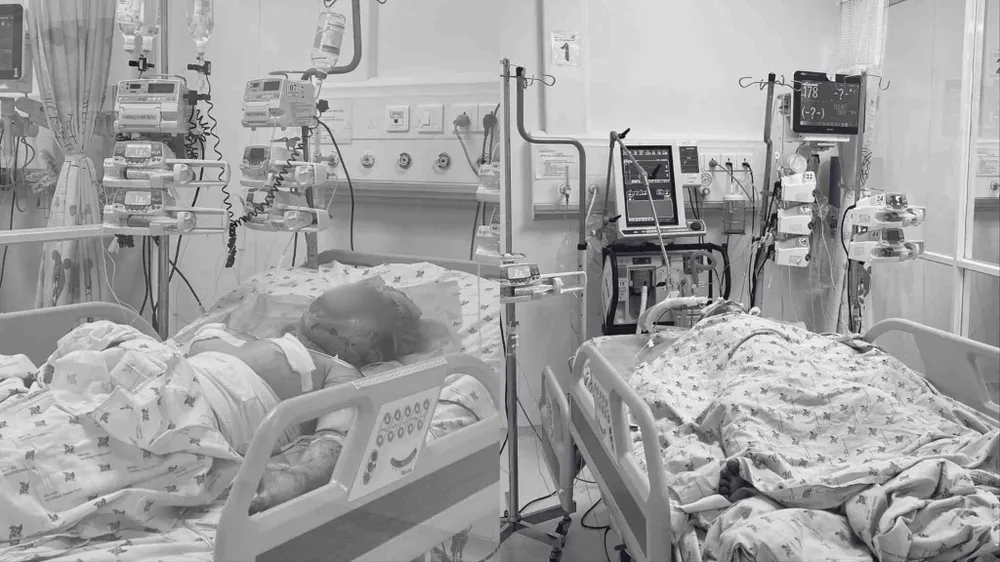 Cấp cứu hai trẻ bỏng nặng, nghi bị cha ruột phóng hỏa
