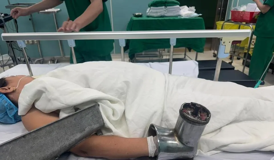 Sốc với hình ảnh người phụ nữ nhập viện cùng chiếc máy xay thịt 