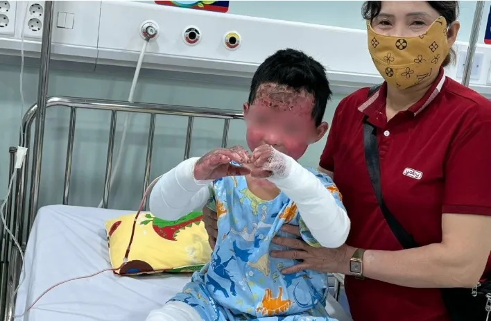 Giành giật mạng sống cho bé trai trong vụ cháy nhà ở Gia Lai 